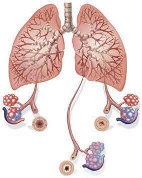 Lungenplakat